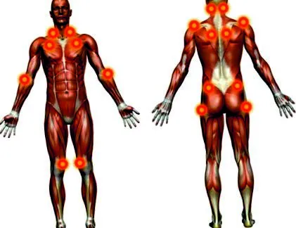 fibromyalgiában