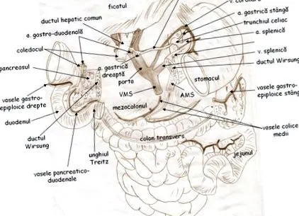 duodenopancreatectomia