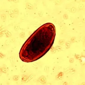 Enterobius vermicularis