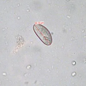 vermicularis