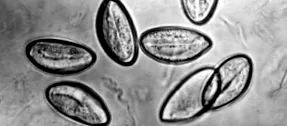 enterobiasis