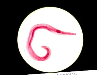 Enterobius vermicularis
