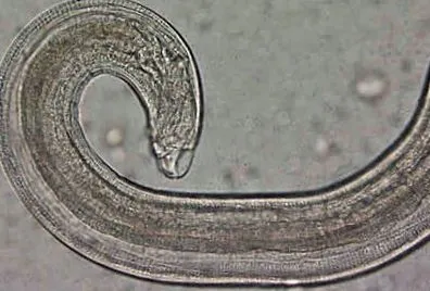 Enterobius vermicularis