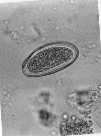 Ascaris lumbricoides