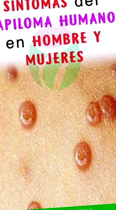 eltávolítani
