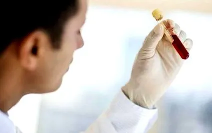 hormonprofil