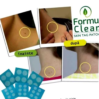 formuclear