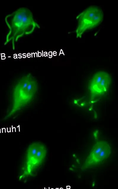 giardia