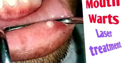 vírus zene zene