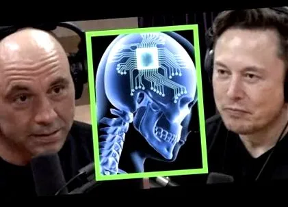 elon implantátum