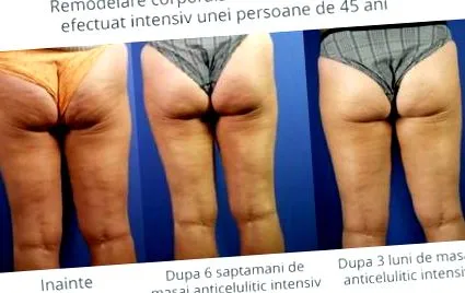 kontúr