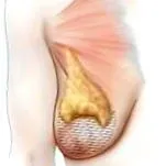 mellemelő