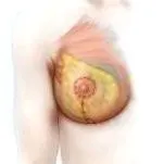 mellemelő