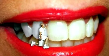 laser stomatologie