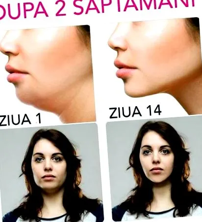 szépségápoló