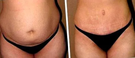 schudnite