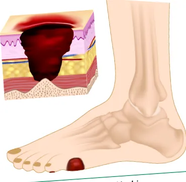 lábápolás