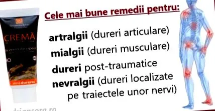 neuralgia ízületi