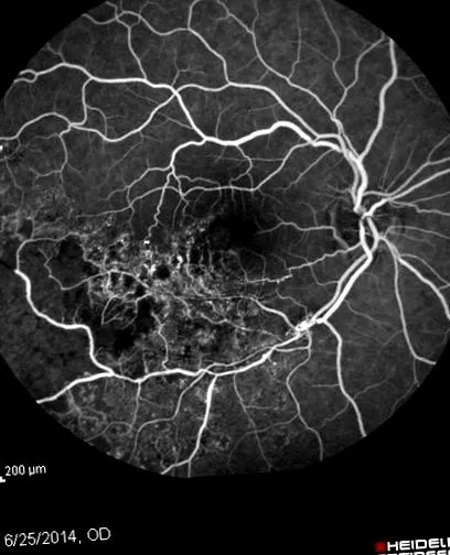 opticlass