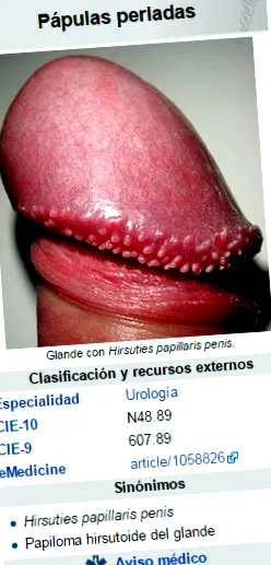 papilloma tünetek