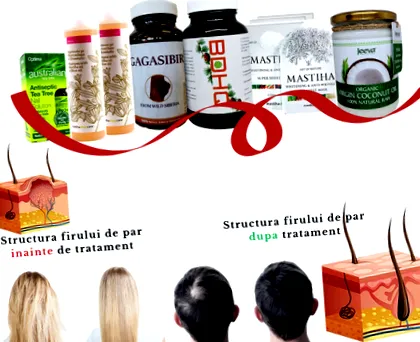 hónapos csomag