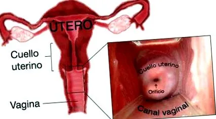 papanicolau kóros