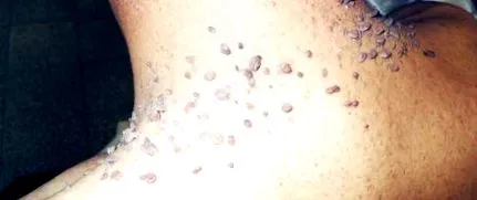 okai