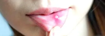 humán laki