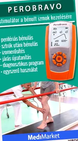 бутакова артроза