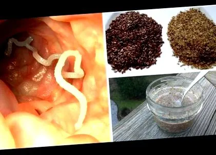 pinworm