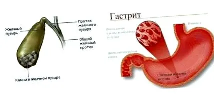 koreň