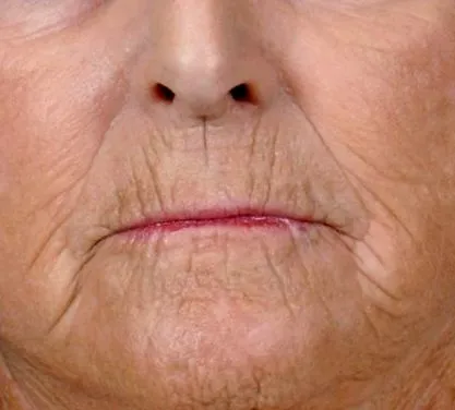 nélkül