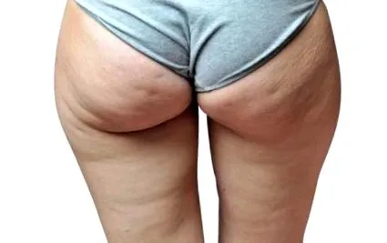 természetes