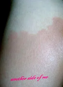 cellufight