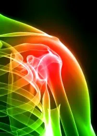 impingement