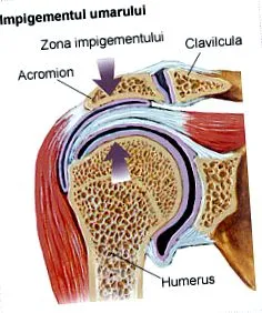szindróma