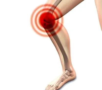 osteoartrózy