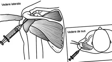 subacromialis