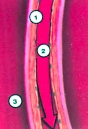 coronariene tratamentul