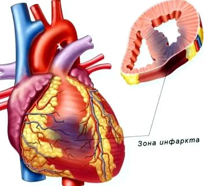 комплекс комплекс