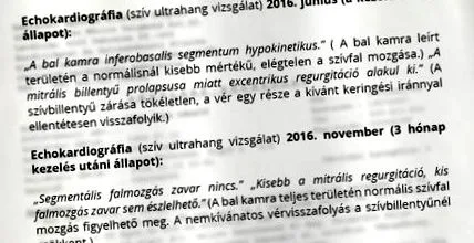 інфаркту інфаркту