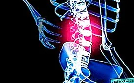 osteopathával