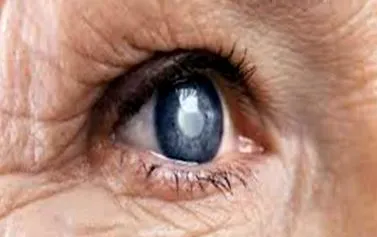 gyógymódokkal osteoarthritis