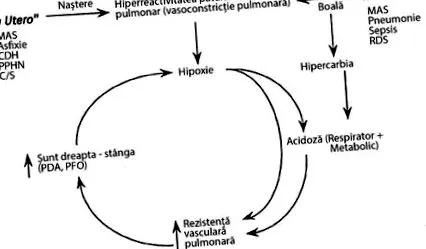 hipertónia
