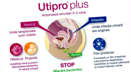 utipro