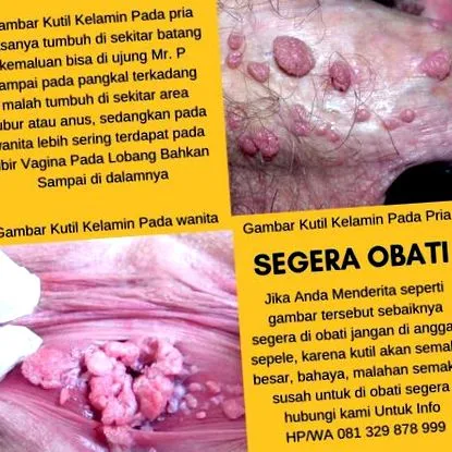 penyebab