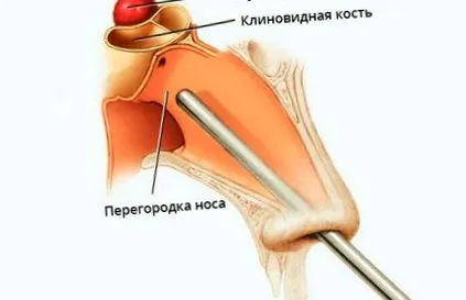 отслабнем отслабнем