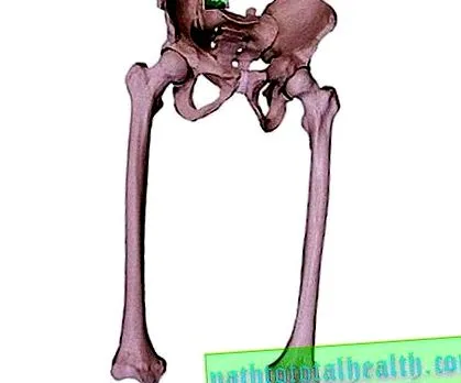 hamis törés