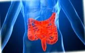crohn-kór leggyakoribb