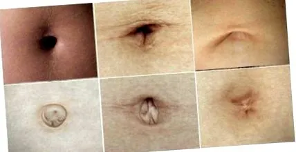 fájdalom esetén